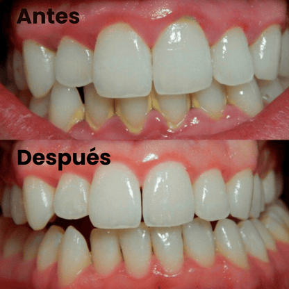 Cepillo De Dientes Quita Sarro